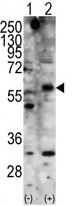 TA300047 - STK11