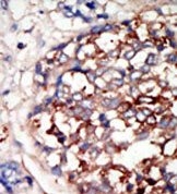 AP14169PU-N - DYRK1B
