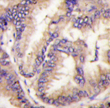 AP13936PU-N - CDKL5 / STK9