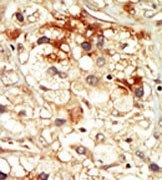 AP14186PU-N - CDK17 / PCTK2
