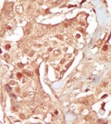 AP14187PU-N - CDK18 / PCTK3