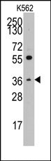 AP14198PU-N - Thrombopoietin