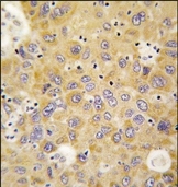 AP14199PU-N - AARS