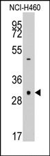 AP14208PU-N - Caspase-3