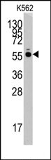 AP14214PU-N - Histidyl-tRNA synthetase / HARS