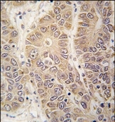 AP14214PU-N - Histidyl-tRNA synthetase / HARS
