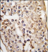 AP14216PU-N - Pumilio 1 / PUM1