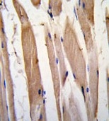 AP14070PU-N - Vinculin (VCL)