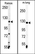 AP14071PU-N - Vinculin (VCL)
