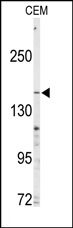 AP14083PU-N - ABCC4 / MRP4