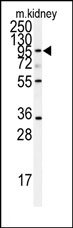 AP14084PU-N - ADAM9 / MDC9