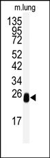 AP14090PU-N - L-xylulose reductase