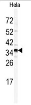 AP14092PU-N - Golgi phosphoprotein 3 / GOLPH3