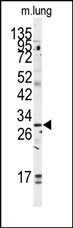 AP14093PU-N - Golgi phosphoprotein 3 / GOLPH3