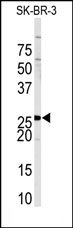 AP14094PU-N - Sprouty homolog 4 / SPRY4