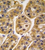 AP14102PU-N - Isocitrate dehydrogenase / IDH