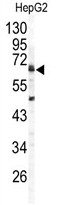 AP14108PU-N - Arylsulfatase B