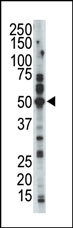 AP14131PU-N - PFTK2 / CDK15