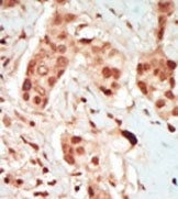AP14131PU-N - PFTK2 / CDK15