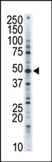 AP14137PU-N - CDK10