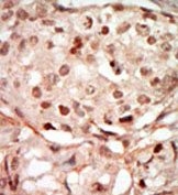 AP14137PU-N - CDK10