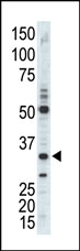 AP14138PU-N - CDK1