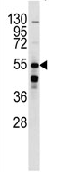 AP13972PU-N - Beta-2 adrenergic receptor