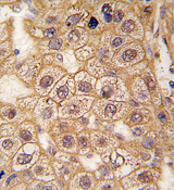 AP13972PU-N - Beta-2 adrenergic receptor