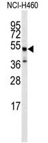 AP13973PU-N - Beta-2 adrenergic receptor