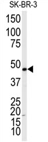 AP13974PU-N - Beta-2 adrenergic receptor
