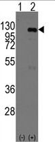 AP13976PU-N - CASC3
