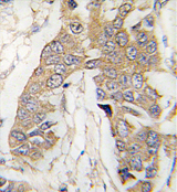 AP13976PU-N - CASC3