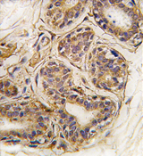 AP13977PU-N - CASC3