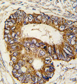 AP13987PU-N - Prohibitin-2