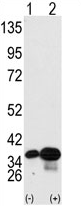 AP13988PU-N - Prohibitin-2