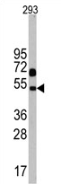 AP13991PU-N - Neuronal pentraxin-1
