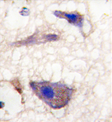AP13991PU-N - Neuronal pentraxin-1