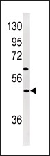 AP13992PU-N - Neuronal pentraxin-1