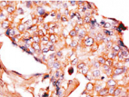 AP13992PU-N - Neuronal pentraxin-1