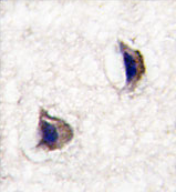 AP13992PU-N - Neuronal pentraxin-1