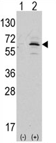 AP13996PU-N - APPBP1