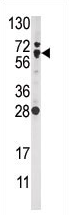 AP13999PU-N - NFE2L2