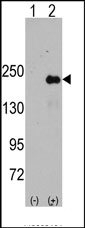 AP14022PU-N - SPAG9 / JIP4