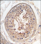 AP14022PU-N - SPAG9 / JIP4