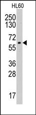 AP14030PU-N - Aromatase