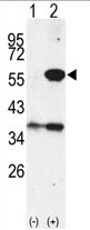 AP14036PU-N - Cytosol aminopeptidase