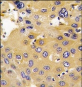 AP14036PU-N - Cytosol aminopeptidase