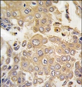 AP14039PU-N - MAPK4 / ERK4