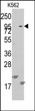 AP14041PU-N - C18orf8