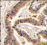 AP14042PU-N - CSNK1A1
